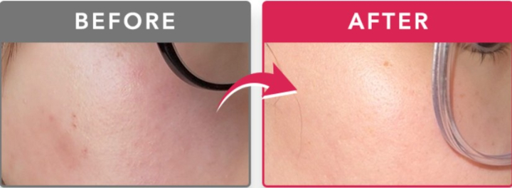 KATAN Cica �_�[�}�q�b�g�Z�����T�ɂ���